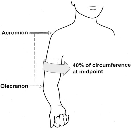 RACGP - Kids' blood pressure measurements differ substantially between arms